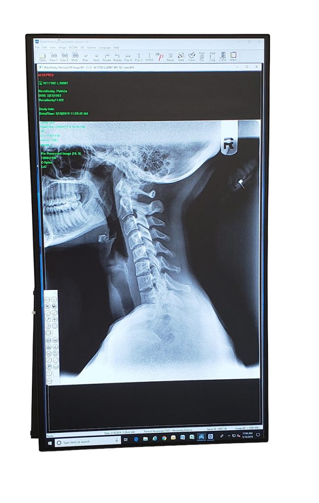Onsite X-Ray